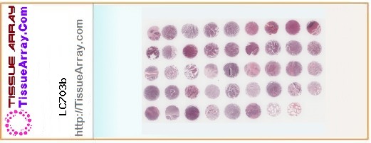TissueArray.Com Tissue Array LC703b