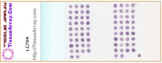 TissueArray.Com Tissue Array LC704