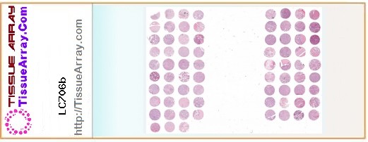 TissueArray.Com Tissue Array LC706b