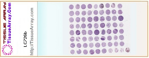 TissueArray.Com Tissue Array LC726b