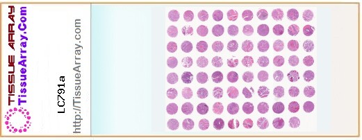 TissueArray.Com Tissue Array LC791a