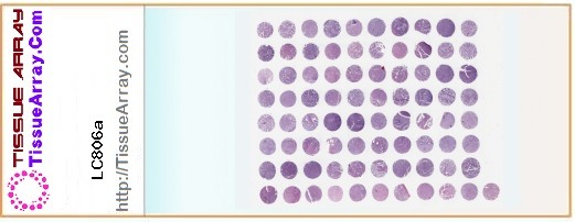 TissueArray.Com Tissue Array LC806a