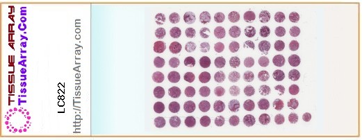 TissueArray.Com Tissue Array LC822