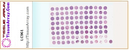 TissueArray.Com Tissue Array LC961