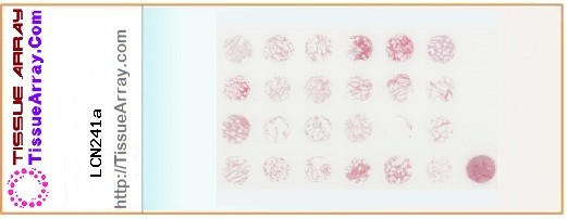TissueArray.Com Tissue Array LCN241a