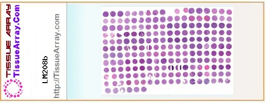 TissueArray.Com Tissue Array LM208b