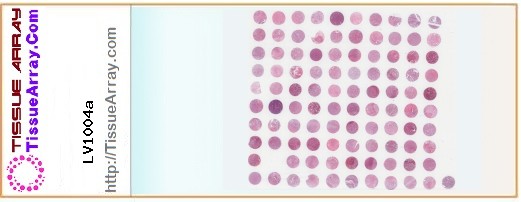 TissueArray.Com Tissue Array LV1004a