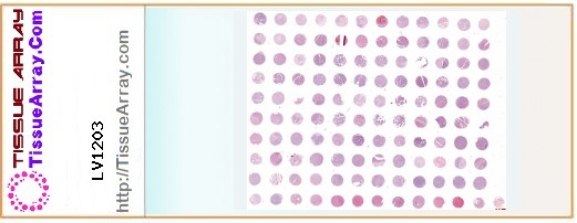 TissueArray.Com Tissue Array LV1203