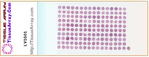 TissueArray.Com Tissue Array LV1601