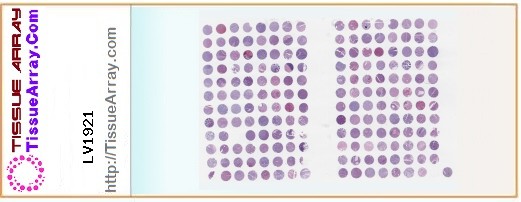 TissueArray.Com Tissue Array LV1921