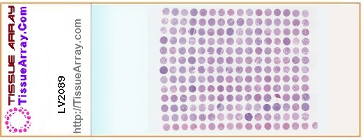 TissueArray.Com Tissue Array LV2089