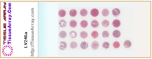 TissueArray.Com Tissue Array LV246a