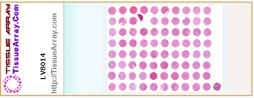 TissueArray.Com Tissue Array LV8014