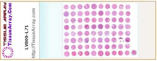 TissueArray.Com Tissue Array LV809-L71
