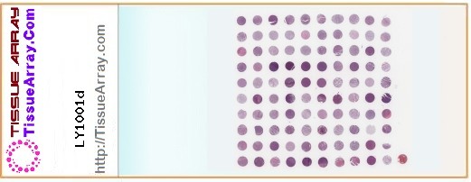 TissueArray.Com Tissue Array LY1001d