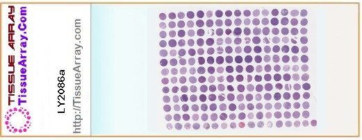 TissueArray.Com Tissue Array LY2086a