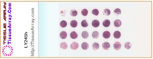 TissueArray.Com Tissue Array LY241h