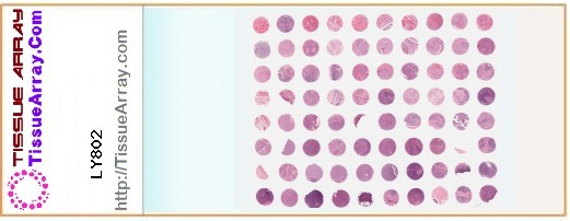 TissueArray.Com Tissue Array LY802