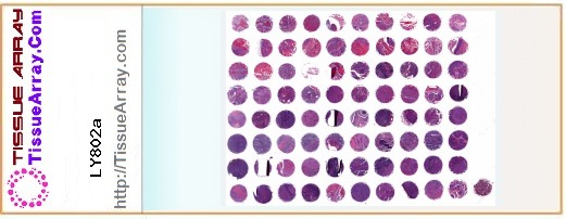 TissueArray.Com Tissue Array LY802a