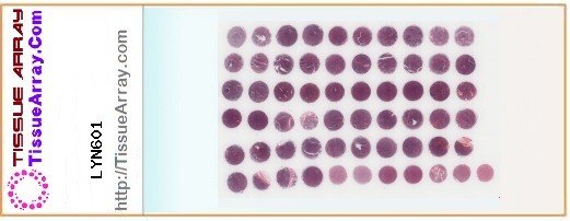 TissueArray.Com Tissue Array LYN601