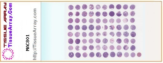 TissueArray.Com Tissue Array MAC801