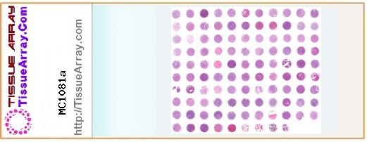 TissueArray.Com Tissue Array MC1081a