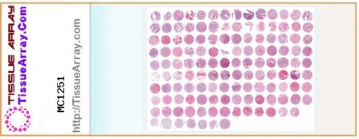 TissueArray.Com Tissue Array MC1251