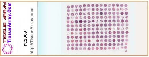 TissueArray.Com Tissue Array MC1809