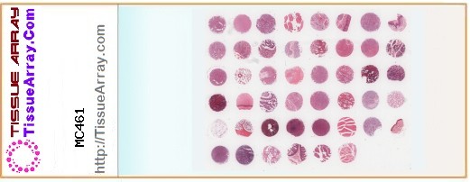 TissueArray.Com Tissue Array MC461