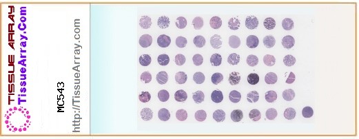 TissueArray.Com Tissue Array MC543