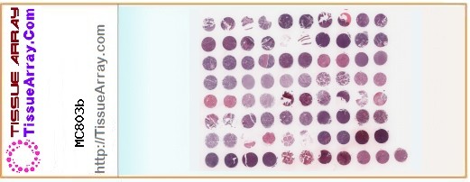 TissueArray.Com Tissue Array MC803b