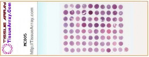 TissueArray.Com Tissue Array MC805