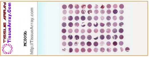 TissueArray.Com Tissue Array MC809b