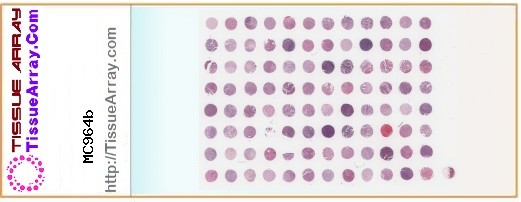 TissueArray.Com Tissue Array MC964b