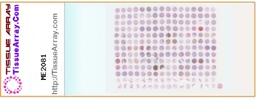 TissueArray.Com Tissue Array ME2081