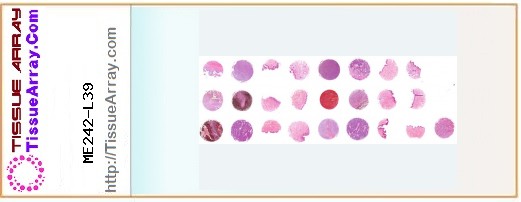 TissueArray.Com Tissue Array ME242-L39