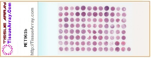 TissueArray.Com Tissue Array MET961b