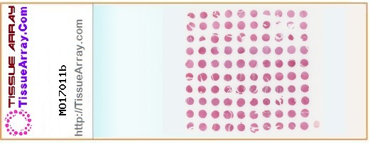 TissueArray.Com Tissue Array MO17011b