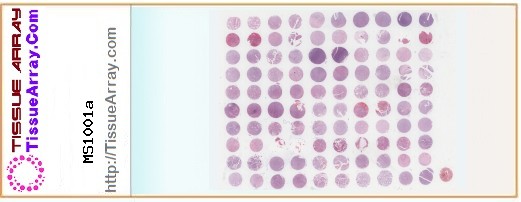 TissueArray.Com Tissue Array MS1001a