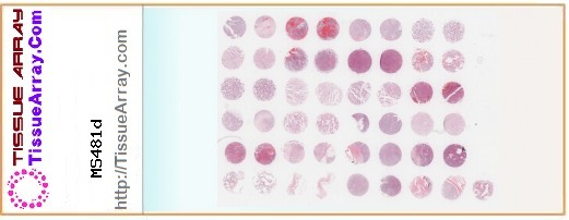 TissueArray.Com Tissue Array MS481d