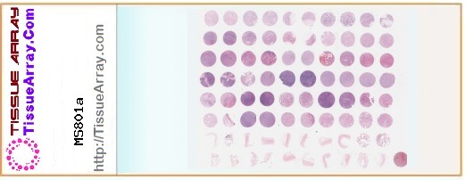TissueArray.Com Tissue Array MS801a