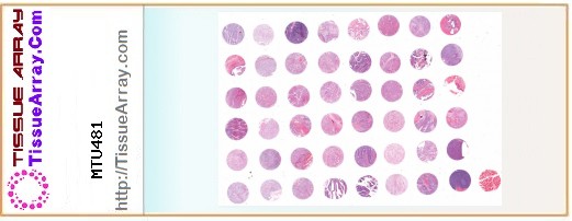 TissueArray.Com Tissue Array MTU481