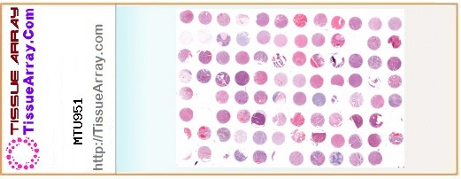 TissueArray.Com Tissue Array MTU951