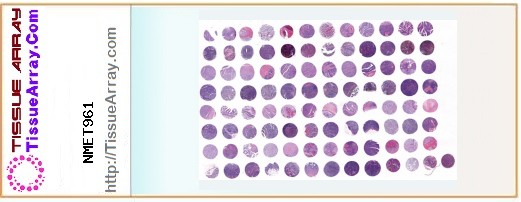 TissueArray.Com Tissue Array NMET961