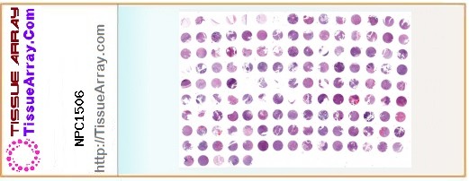 TissueArray.Com Tissue Array NPC1506
