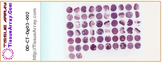 TissueArray.Com Tissue Array OD-CT-Dg03-002