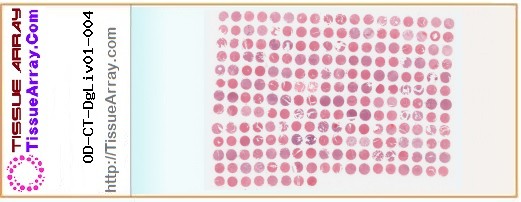TissueArray.Com Tissue Array OD-CT-DgLiv01-004
