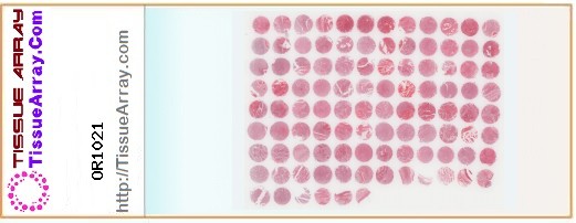 TissueArray.Com Tissue Array OR1021