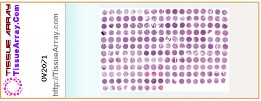 TissueArray.Com Tissue Array OV2071
