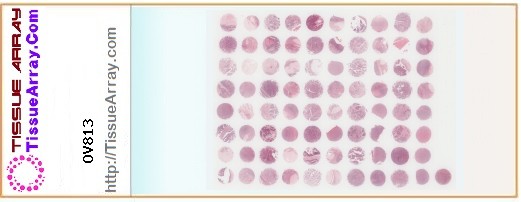 TissueArray.Com Tissue Array OV813